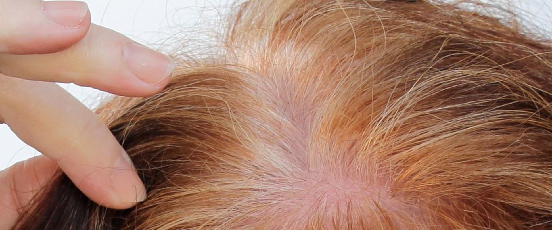 How Long Do PRP Injections Last?