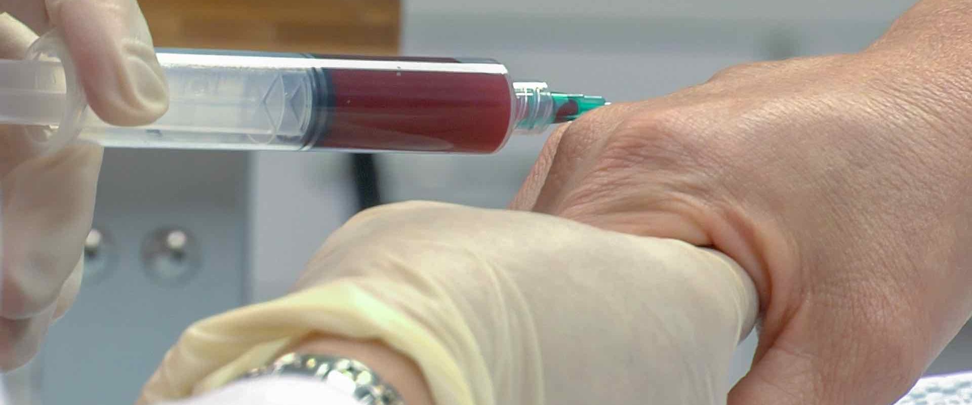 Is a PRP Injection Worth It?