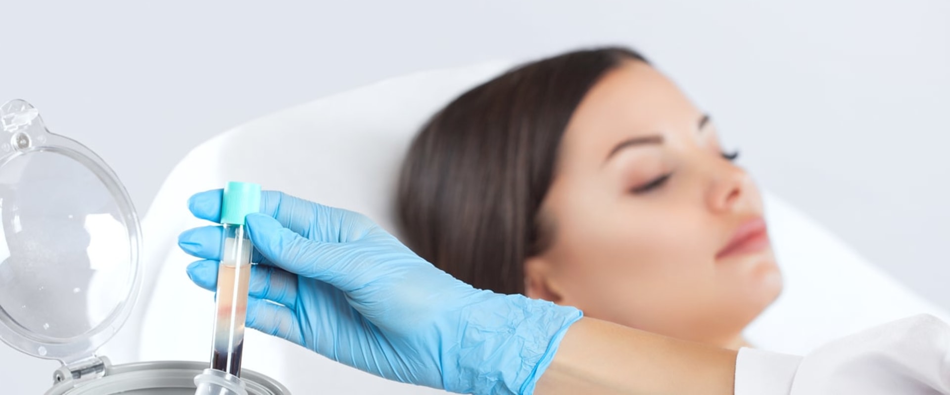 Is PRP a Long-Term Treatment?