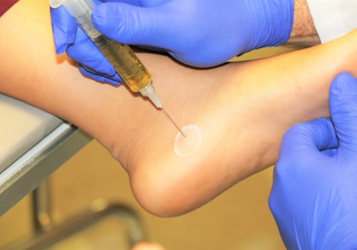 What Does a PRP Injection Feel Like?