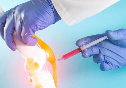 Is Medicare Covering PRP Injections?